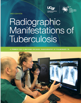nurse practitioner in between two physicians examining chest radiographic images  