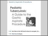 pediatric tuberculosis gastric aspirate procedure cover