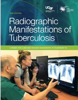 3rd edition of Radiographic Manifestations of Tuberculosis cover image