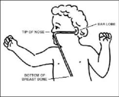 diagram of a child with tip of nose, ear lobe, and bottom of breast bone labeled 