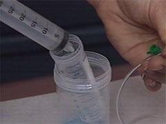 Contents of syringe is being emptied into a special bicarbonate-containing gastric aspirate tube.