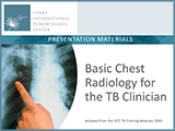 Go to Basic Chest Radiology for the TB Clinician PowerPoint Slide Set