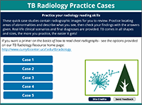 Go to Tuberculosis Radiology Practice Case Page