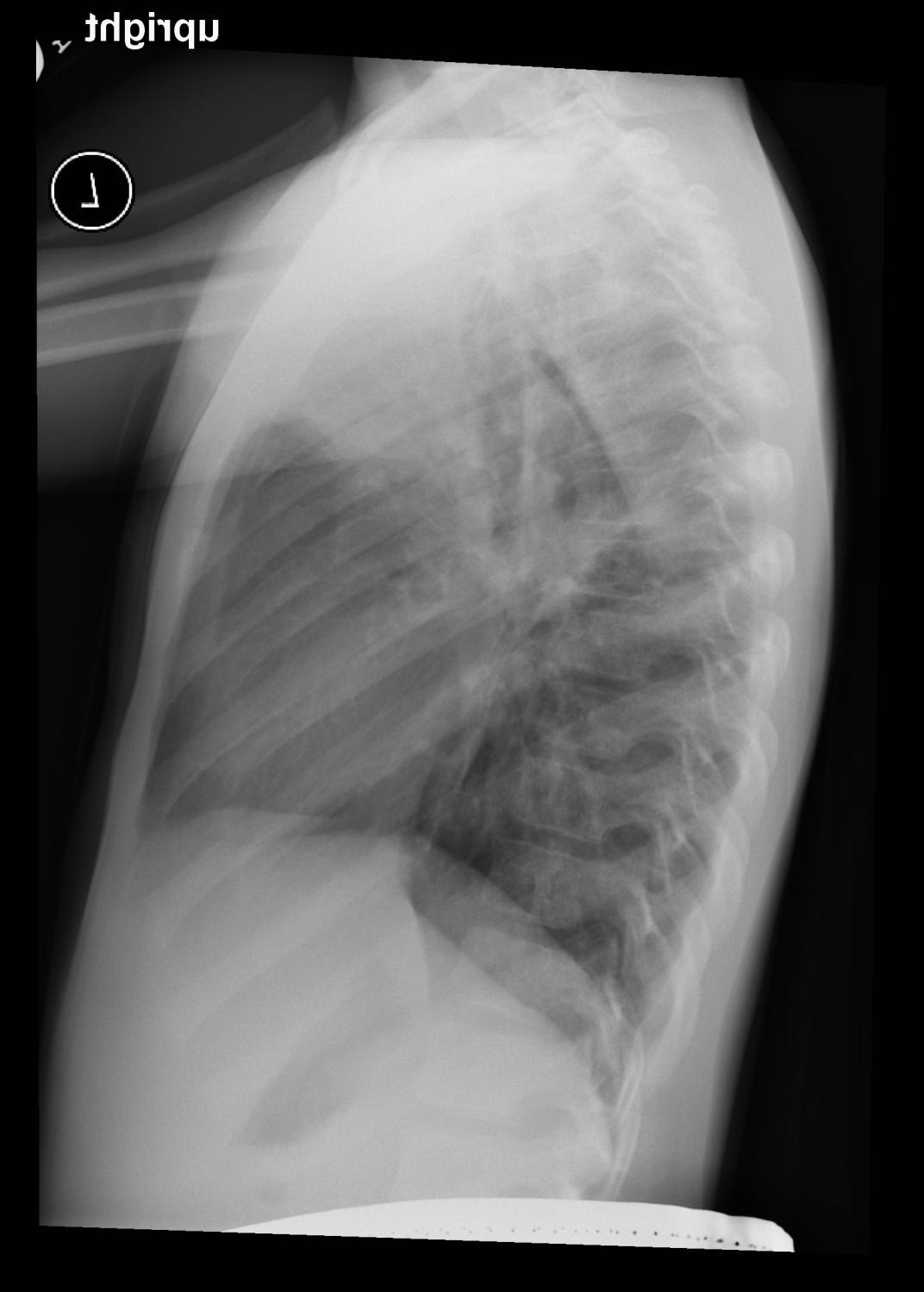 Consolidation/Opacities