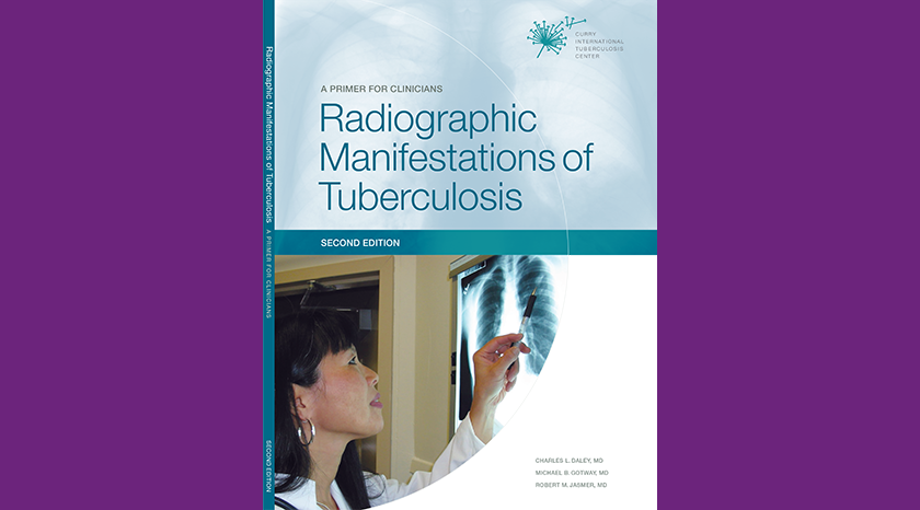 female physician examining a chest radiographic image