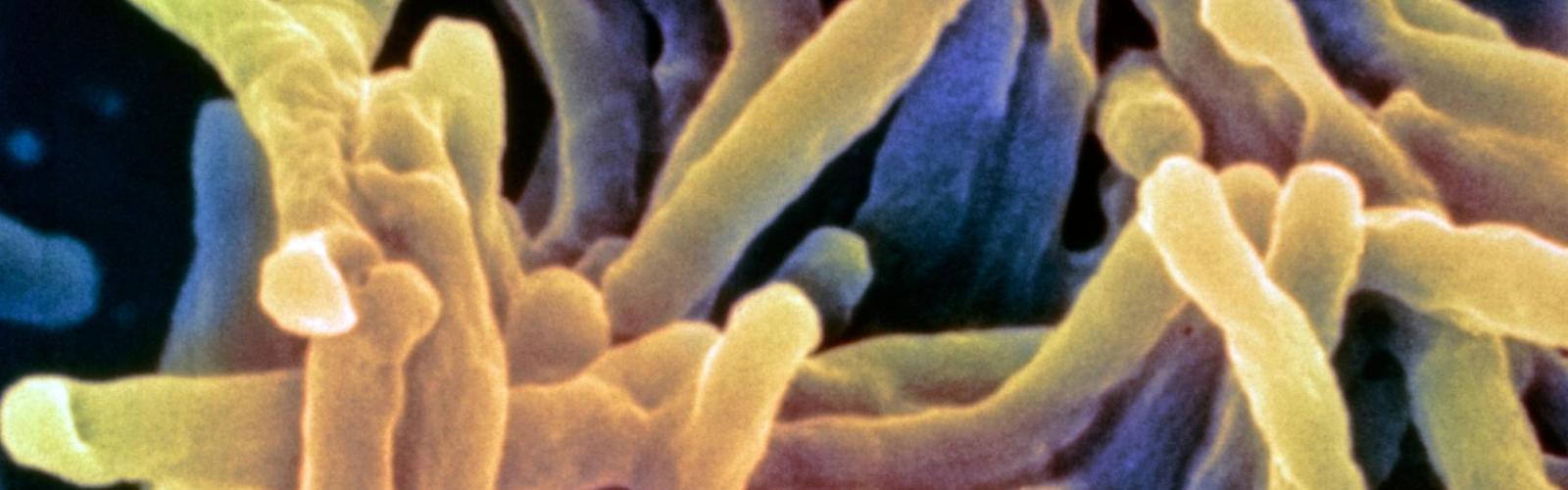 Close up of virus