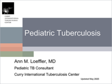 pediatric tuberculosis online presentation