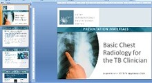Go to online Basic Chest Radiology for the TB Clinician Presentation Slide Set (Teaching Tool Set 1 of 2)