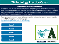 Go to online Tuberculosis Radiology Practice Cases page Go to online Tuberculosis Radiology Practice Cases page