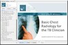 Go to online Basic Chest Radiology for the TB Clinician (self study) page
